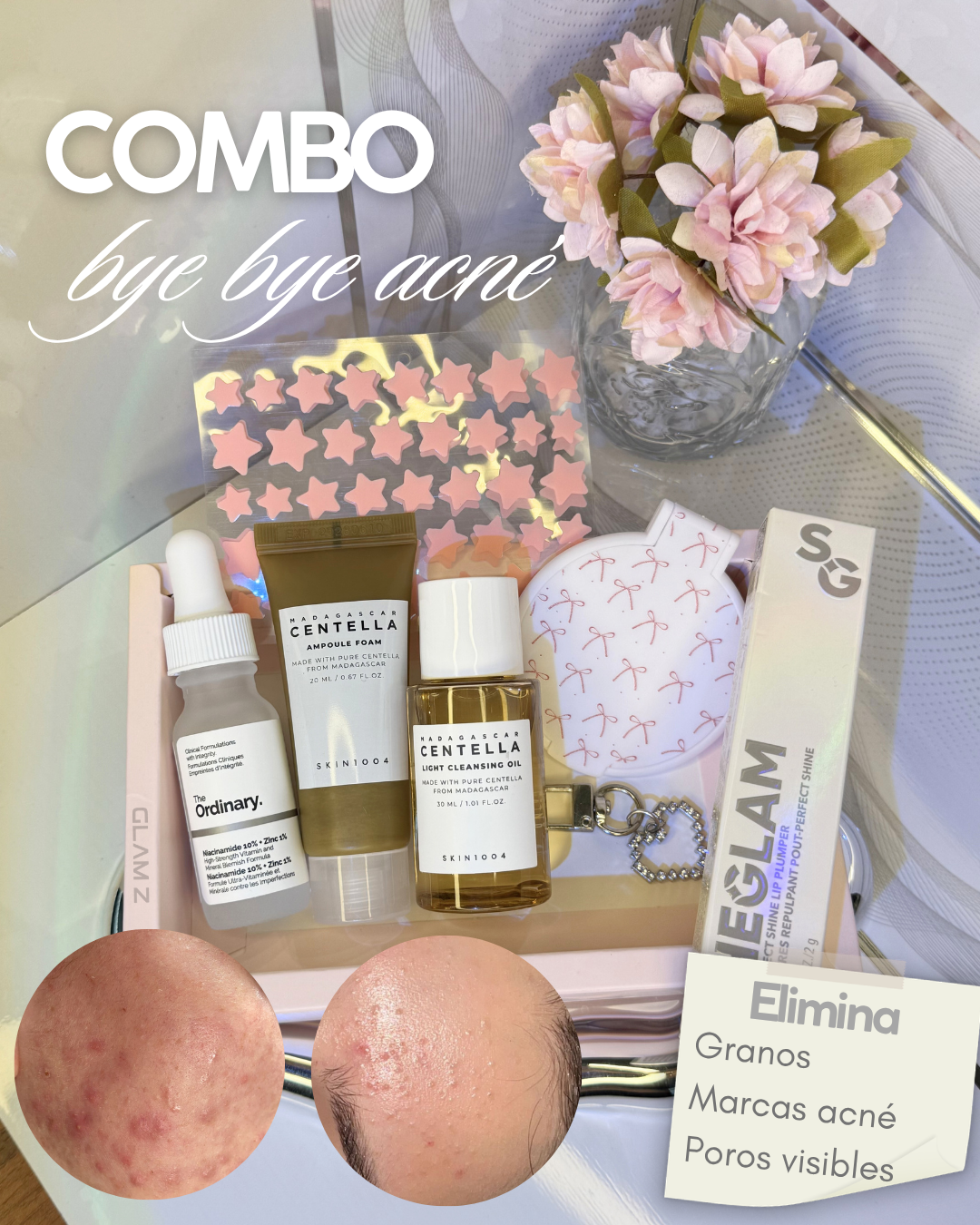Combo Skincare bye bye acné entrega inmediata